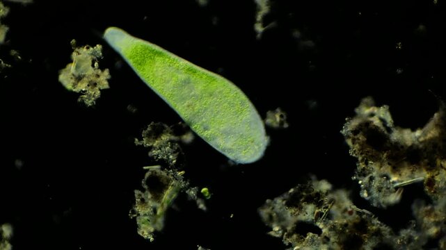 Stentor  under microscope at 100x magnification