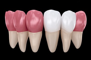 Obraz premium Dental model showing teeth, some with pink enamel and some white