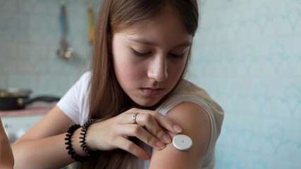 Girl with diabetes checking blood glucose level at home using continuous glucose monitor. The girl checks the glucose level