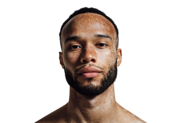 Portrait of a young man with freckles and a well-groomed beard against a solid black background