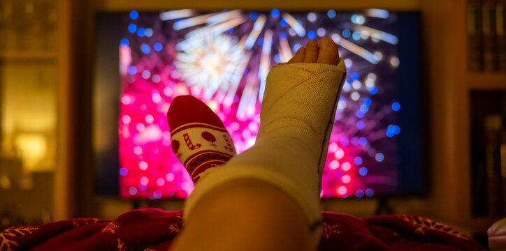 Person with a broken foot in a plaster cast and christmas socks watching fireworks on tv during the holidays, embodying recovery, resilience, and adaptation - Powered by Adobe