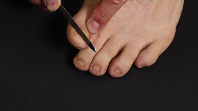 A man files his toenails with a nail file, pedicure close-up. Pedicure of men's feet on a black background.