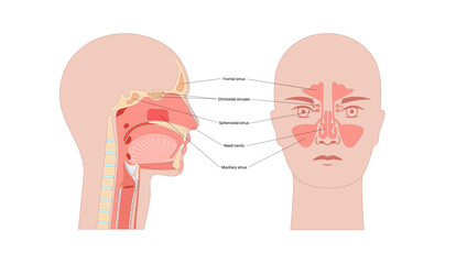 Paranasal sinus poster