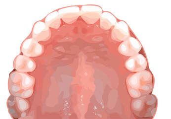 上顎 © 西部リノ