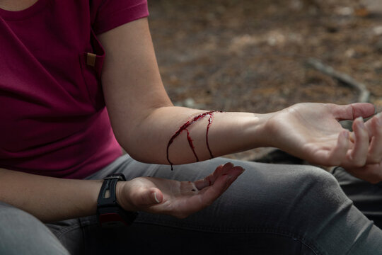 Person providing first aid care for bleeding arm wound during emergency training scenario