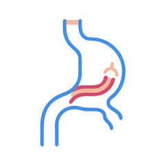 Anatomical illustration showing stomach and internal lining layers