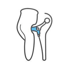 Hip replacement illustration showing prosthesis with pelvis bone