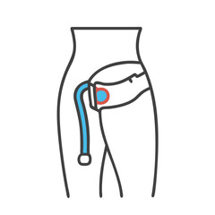 Urethral catheterization illustration with stylized anatomical outlines and bright accents