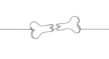 A delicate line drawing that shows a broken bone.