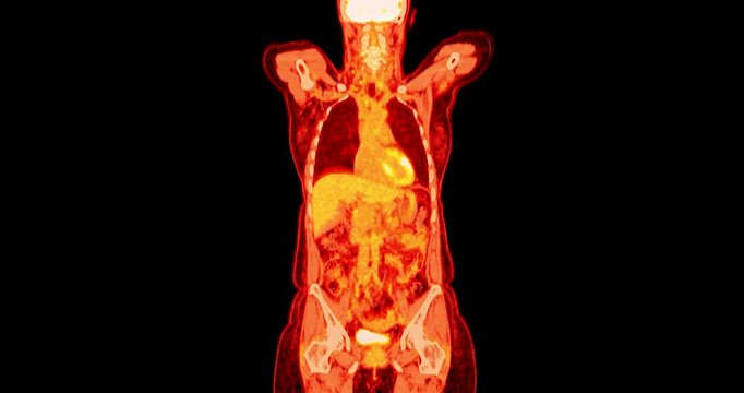 Colorful PET scan whole body imaging highlighting brain, spinal cord and internal organs for radiology, nuclear medicine and medical research.