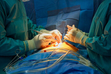 Male and female surgeons focus intensely while performing surgery in operating room. Medical instruments surround them, creating a serious atmosphere.