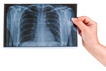 in a female hand x-ray of the lungs isolated on a white background