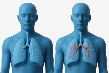Side-by-side 3D render of two blue torso silhouettes. Left shows normal lungs with wide clear bronchi, right shows narrowed bronchi with red constricted segments symbolizing asthma, airway obstruction