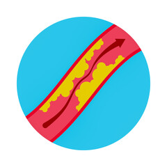 Medical illustration set on cardiology and healthcare. Includes diagrams of heart disease, atherosclerosis, dialysis, plus 3D stethoscopes and blood pressure icons. Isolated vector graphics.