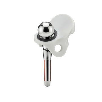 A highly detailed artificial hip joint implant, polished metallic femoral stem and bright white acetabular cup on a pristine, seamless transparent background with diffused studio lighting, concept of