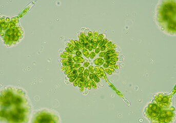 Microscopic View of a Spherical Colony of Green Algae with a Filamentous Appendage