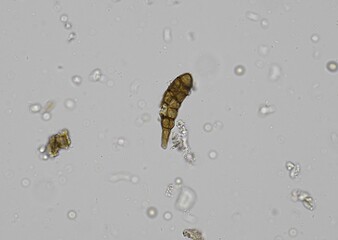 soil microorganisms under a microscope including amoeba, flagellates, nematodes, fungi, bacteria	