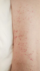 Porcelain skin displays a mosaic of mysterious red constellations, evoking whispers of Holi's vivid tapestry and skin journey rites