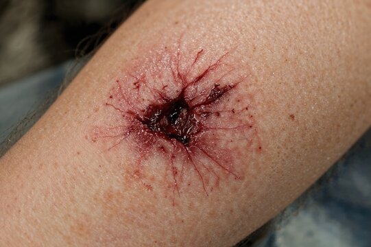 Close-up of a contaminated dog bite wound with risk of infection