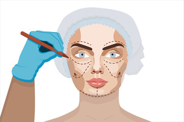 An illustration of a cosmetic surgery procedure showing a gloved hand marking a woman's face with a marker, wearing a surgical cap, on a white background.