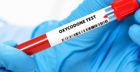 Naklejka premium Oxycodone Test