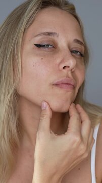 Vertical video of a young blonde woman showing her cheeks and defined cheekbones after buccal fat removal surgery. Confident and happy with the transformation