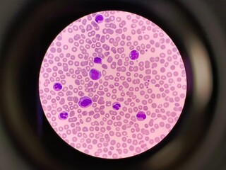 Human blood under a microscope in laboratory. 