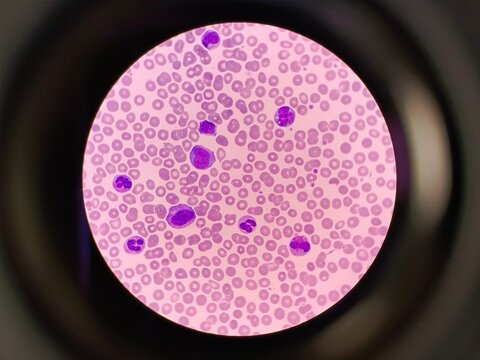 Human blood under a microscope in laboratory.