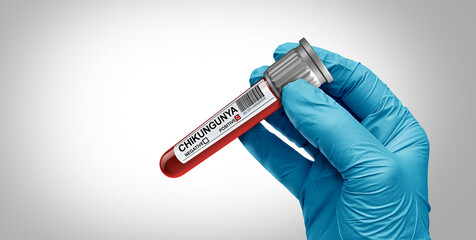 Obraz premium Chikungunya virus Diagnosis blood test as an outbreak concept due to a a mosquito borne virus pathogen causing high fever severe joint pain and other flu like symptoms as a doctor holding a vial.