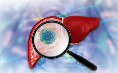 Magnifying glass finding hepatitis virus in liver, liver disease. 3d illustration
