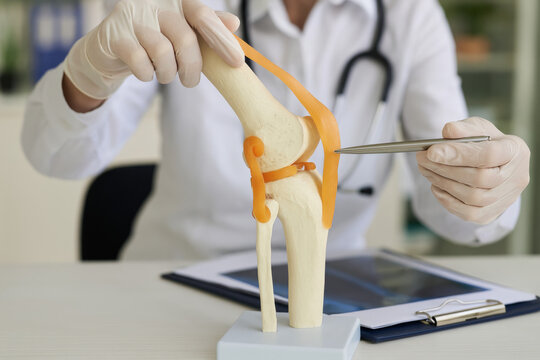 Doctor Explaining Meniscus Tear with Knee Joint Model