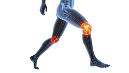 3d medical illustration of running human body with knee pain and discomfort isolated on white background