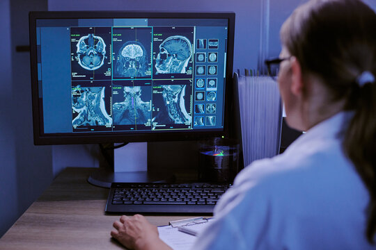 Caucasian middle aged woman analyzing brain and spinal MRI scans on computer monitor in medical office, reviewing detailed radiology images for diagnosis and patient assessment