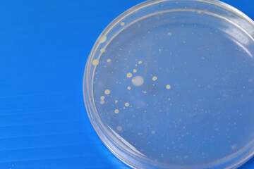 Colonies of bacteria growth on agar plate medium in laboratory.	