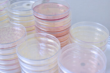 Colonies of bacteria growth on agar plate medium in laboratory.	