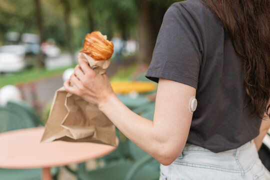 Close-up side view of a woman wearing a continuous glucose monitor standing in a park in the summer eating a croissant