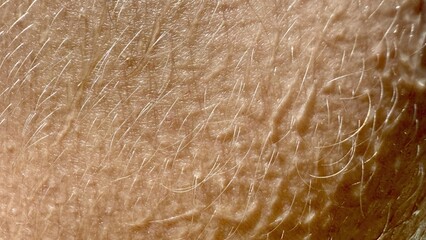 macro closeup of human skin with fine hair under natural light showing detailed texture for medical background or organic surface design