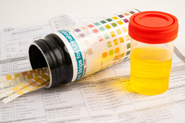 Urinalysis, urine cup with reagent strip pH paper test and comparison chart in laboratory.