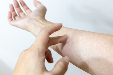 汗疹に塗り薬を塗っている