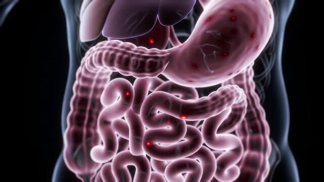 Inflamed Human Digestive System: Stomach, Intestines, Medical Illustration