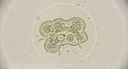 Irregularly shaped microorganism with pseudopodia and nucleus  