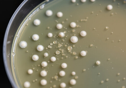 Macro photograph of Petri dish with Malassezia furfur culture  
