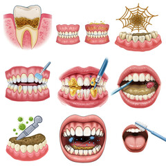 Gingiva recession. 3D illustration of dental disease clinic, bacterial, teeth, tartar, clinical, closeup, closeup
