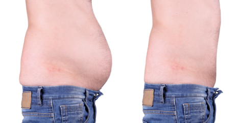 before and after of man with belly fat