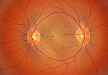 Detailed medical image of human eye retina showing blood vessels