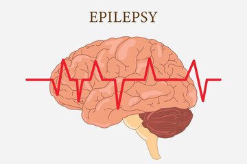 Human brain illustration with red heartbeat line representing epilepsy and neurological disorder. eps 10