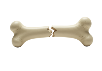 Isolated Broken bone, skeleton part, fracture, medical care, healthcare, orthopedic concept