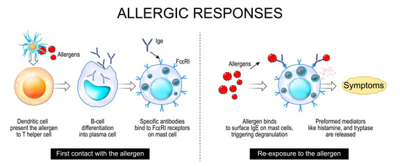 Allergy mechanism and Allergic responses