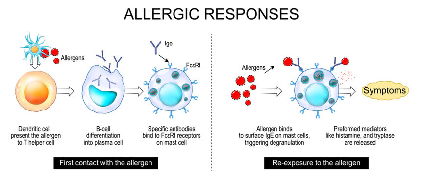 Allergy mechanism and Allergic responses