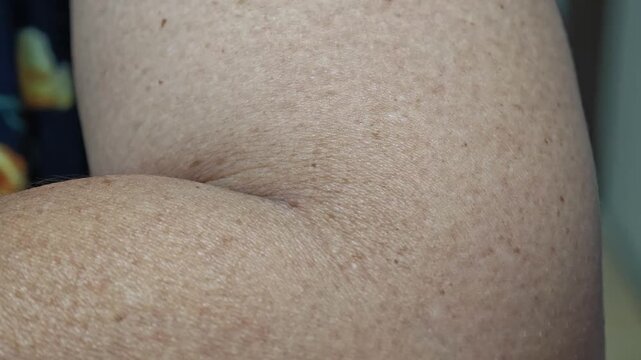 Arm muscle twitching. Muscle spasms.